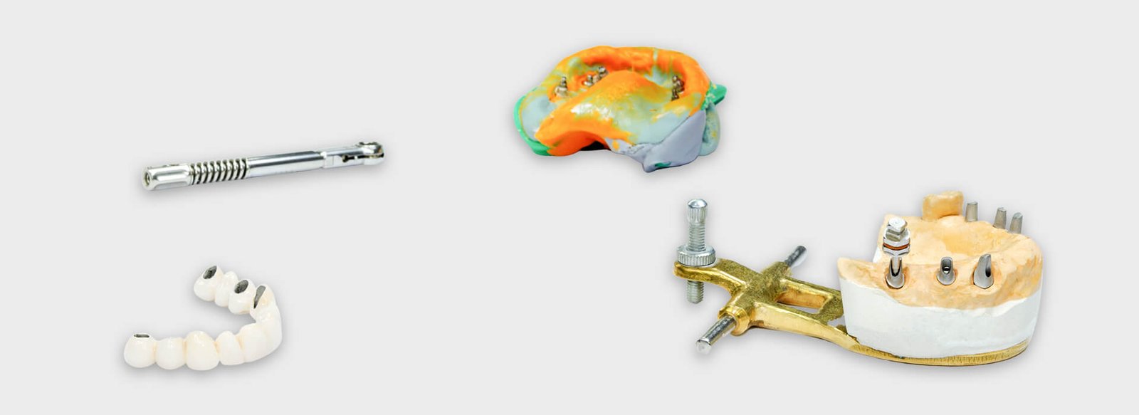 Dental Implants Vs Dentures: Which one is better