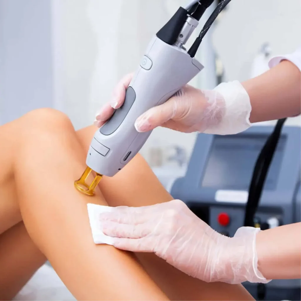 Full Body Laser Hair Removal Offer in Dubai | Up to 50% OFF