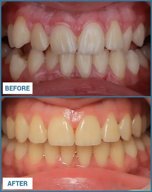 Scaling and Polishing Results