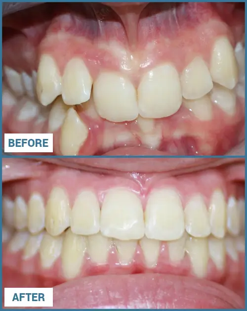 Scaling and Polishing Results