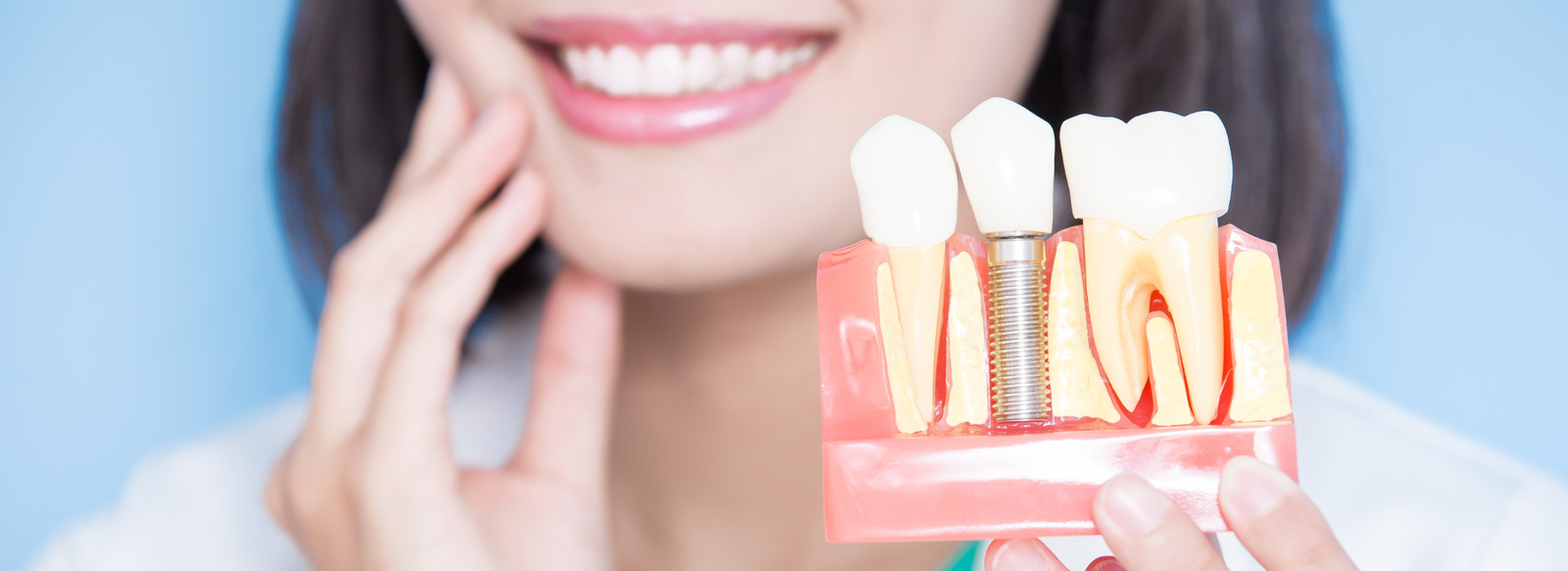 When Dental Implants Are Not an Option