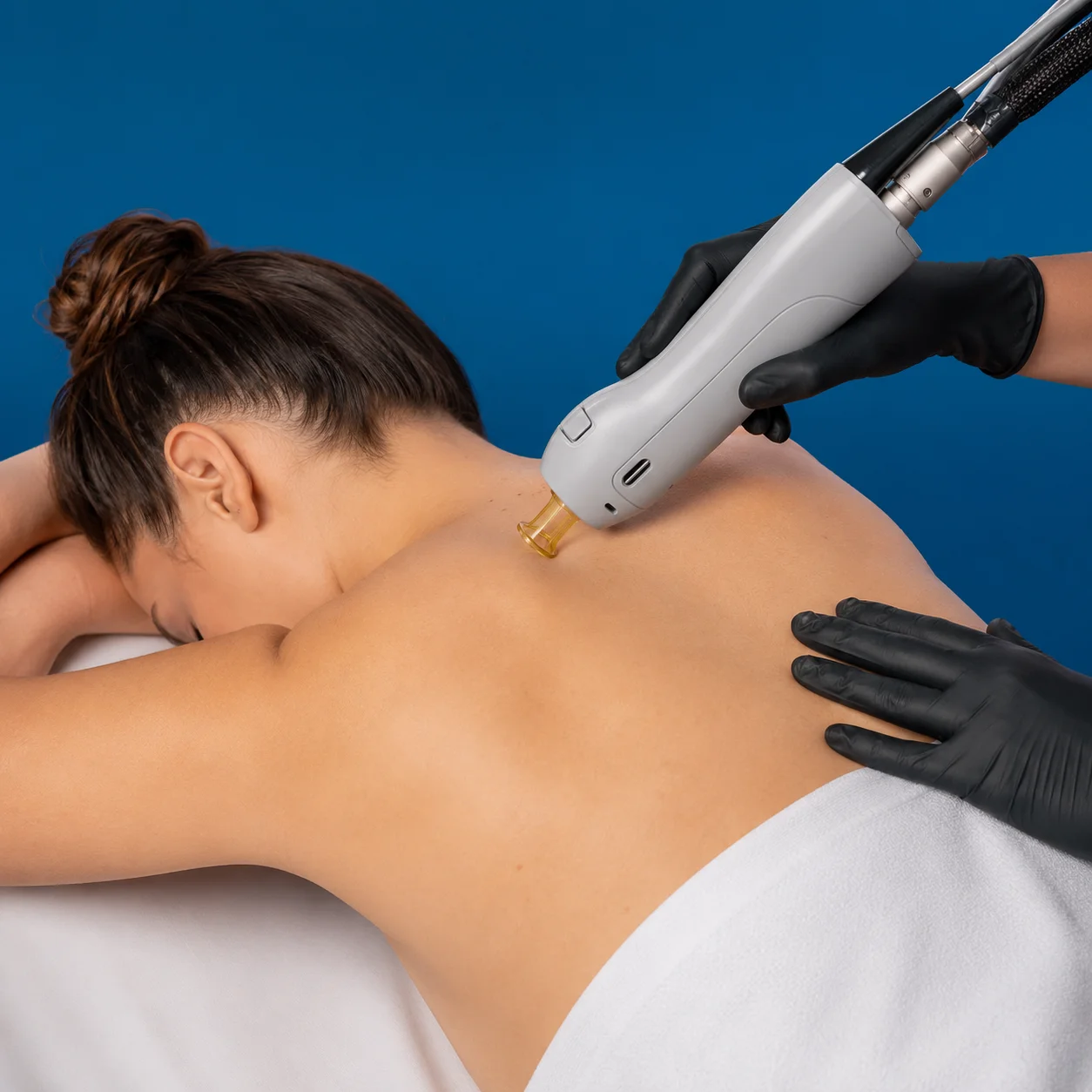 Back / Shoulder Laser Hair Removal
